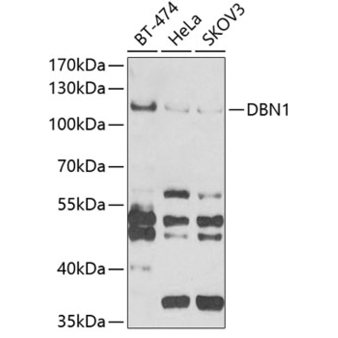 DBN1 Rabbit Polyclonal Antibody
