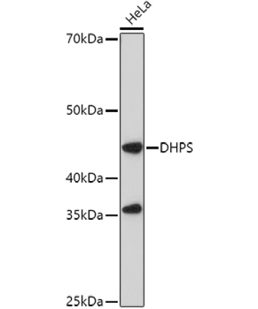 DHPS Rabbit Polyclonal Antibody