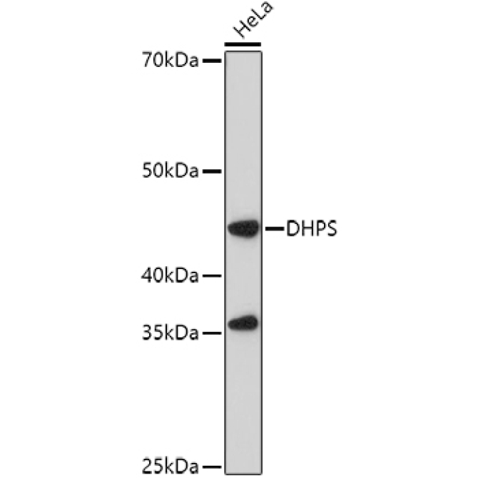 DHPS Rabbit Polyclonal Antibody