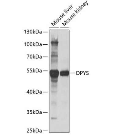 DPYS Rabbit Polyclonal Antibody