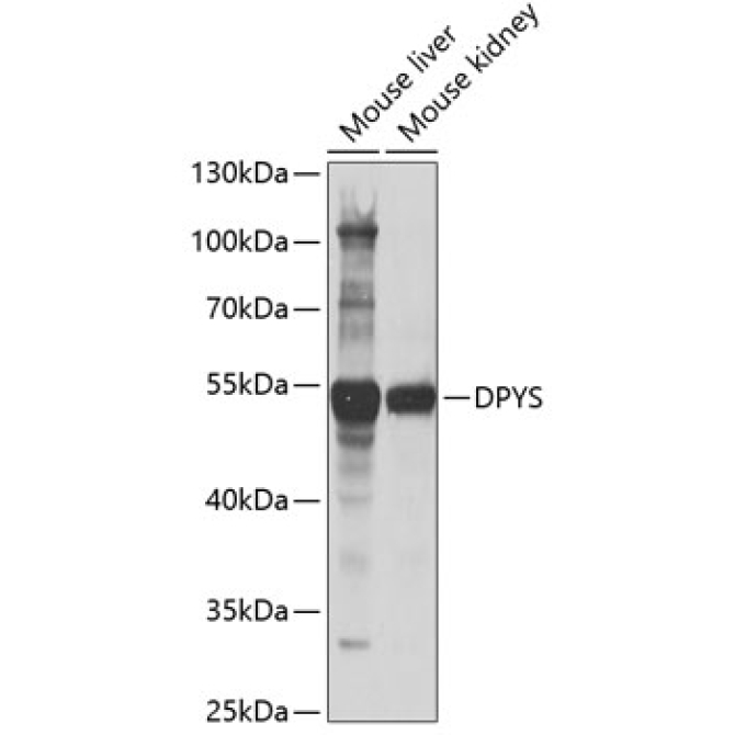 DPYS Rabbit Polyclonal Antibody