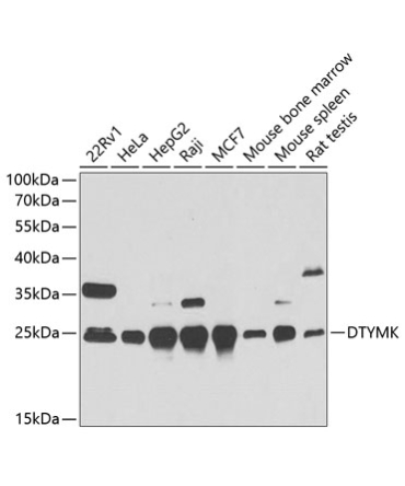 DTYMK Rabbit Polyclonal Antibody