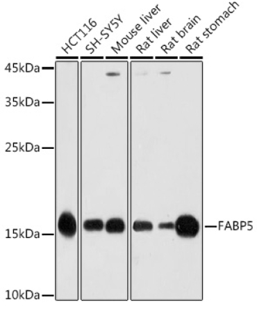 FABP5 Rabbit Polyclonal Antibody
