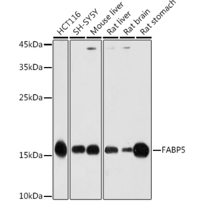 FABP5 Rabbit Polyclonal Antibody