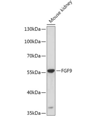 FGF9 Rabbit Polyclonal Antibody