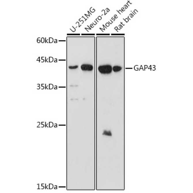 GAP43 Rabbit Polyclonal Antibody