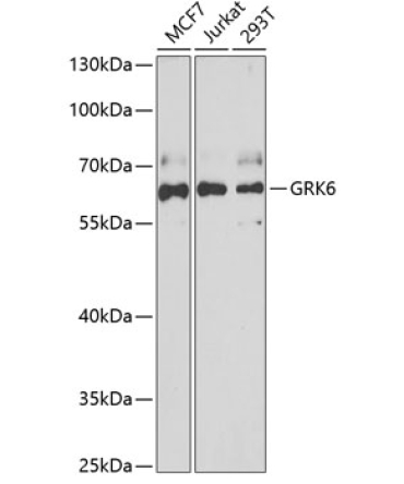 GRK6 Rabbit Polyclonal Antibody