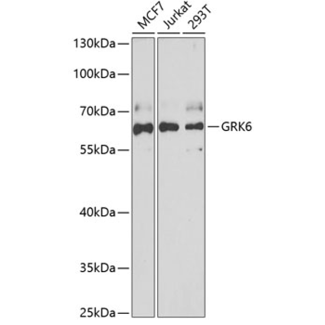 GRK6 Rabbit Polyclonal Antibody