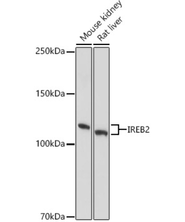 IRP2 Rabbit Polyclonal Antibody