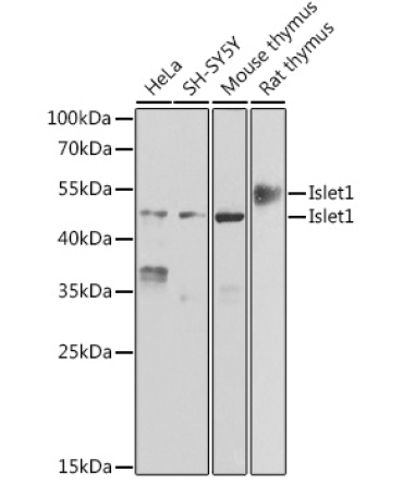Islet1 Rabbit Polyclonal Antibody