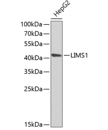 LIMS1 Rabbit Polyclonal Antibody