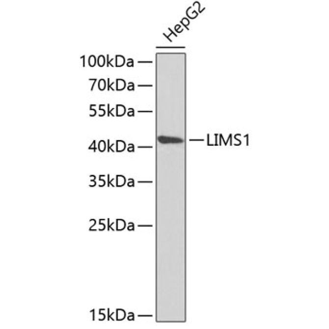 LIMS1 Rabbit Polyclonal Antibody