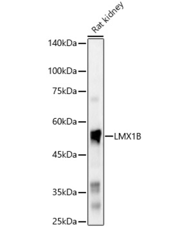 LMX1B Rabbit Polyclonal Antibody