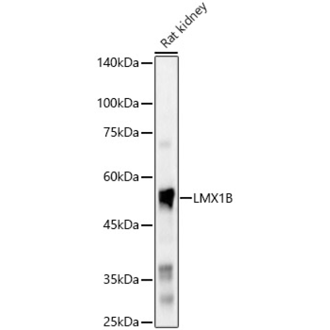 LMX1B Rabbit Polyclonal Antibody