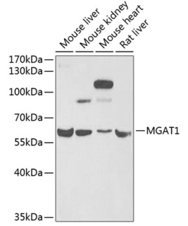 MGAT1 Rabbit Polyclonal Antibody