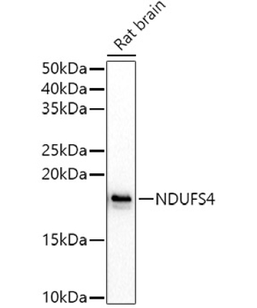 NDUFS4 Rabbit Polyclonal Antibody