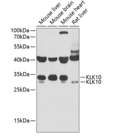 KLK10 Rabbit Polyclonal Antibody