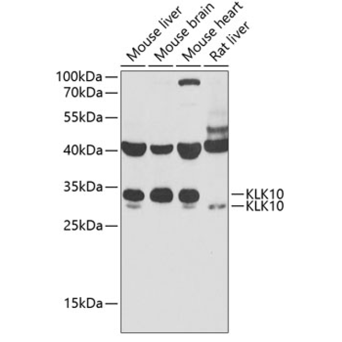 KLK10 Rabbit Polyclonal Antibody