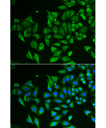 CLEC3B/Tetranectin Rabbit Polyclonal Antibody