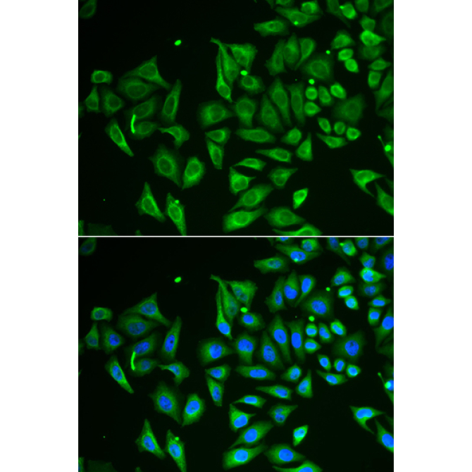 CLEC3B/Tetranectin Rabbit Polyclonal Antibody