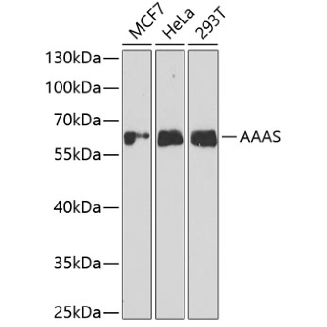 AAAS Rabbit Polyclonal Antibody