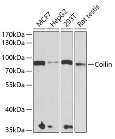 Coilin Rabbit Polyclonal Antibody
