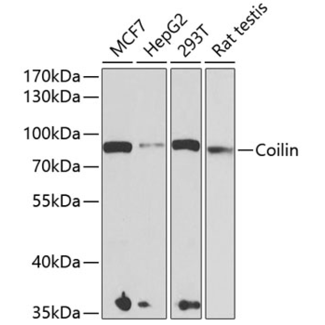 Coilin Rabbit Polyclonal Antibody