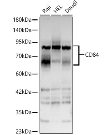 CD84 Rabbit Polyclonal Antibody