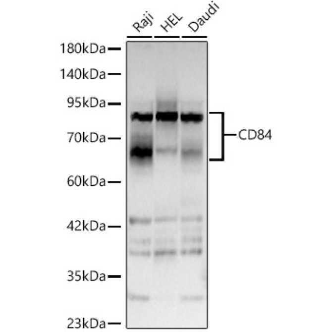 CD84 Rabbit Polyclonal Antibody