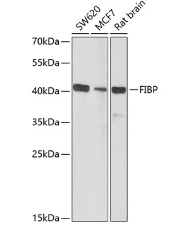 FIBP Rabbit Polyclonal Antibody