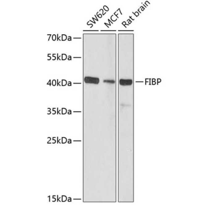 FIBP Rabbit Polyclonal Antibody