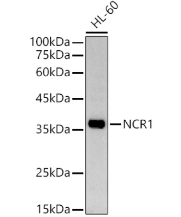 NCR1 Rabbit Polyclonal Antibody