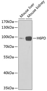 H6PD Rabbit Polyclonal Antibody