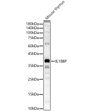 IL18BP Rabbit Polyclonal Antibody
