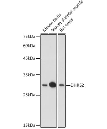 DHRS2 Rabbit Polyclonal Antibody