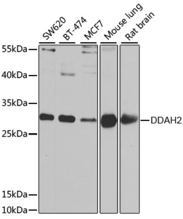 DDAH2 Rabbit Polyclonal Antibody