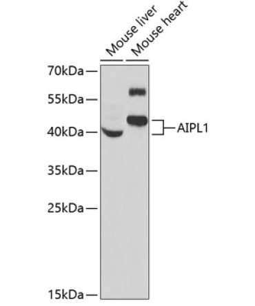 AIPL1 Rabbit Polyclonal Antibody