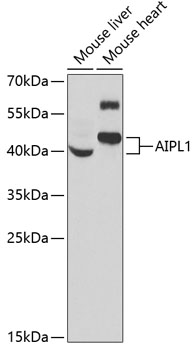 AIPL1 Rabbit Polyclonal Antibody