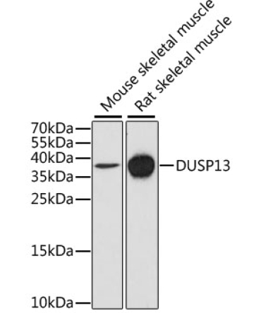 DUSP13 Rabbit Polyclonal Antibody