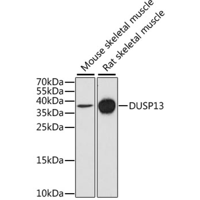 DUSP13 Rabbit Polyclonal Antibody