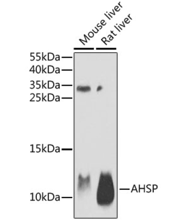 AHSP Rabbit Polyclonal Antibody