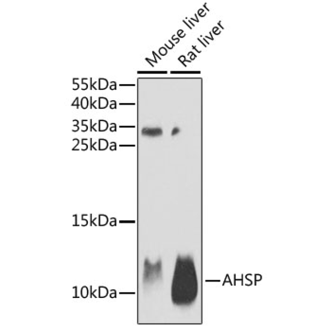 AHSP Rabbit Polyclonal Antibody