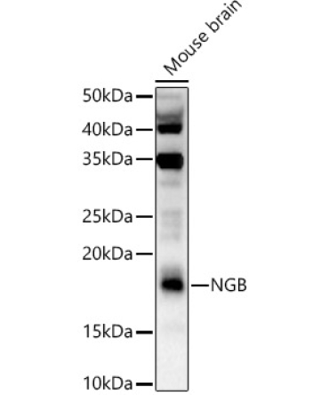 NGB Rabbit Polyclonal Antibody