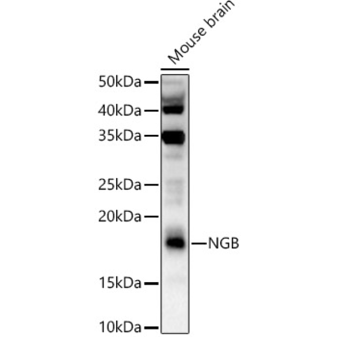 NGB Rabbit Polyclonal Antibody