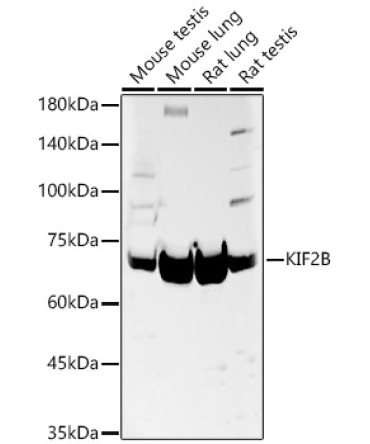 KIF2B Rabbit Polyclonal Antibody