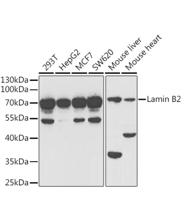 Lamin B2 Rabbit Polyclonal Antibody