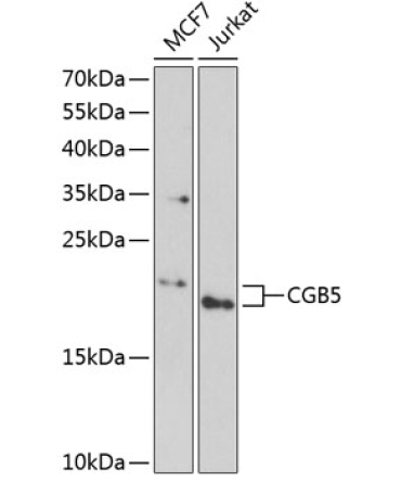 CGB5 Rabbit Polyclonal Antibody