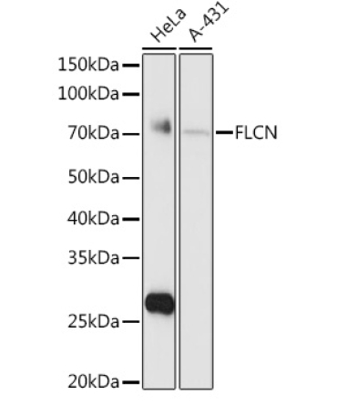 FLCN Rabbit Polyclonal Antibody