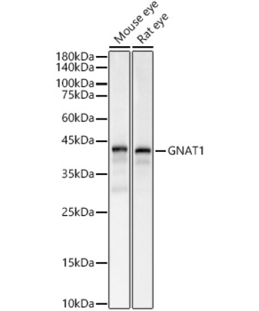 GNAT1 Rabbit Polyclonal Antibody