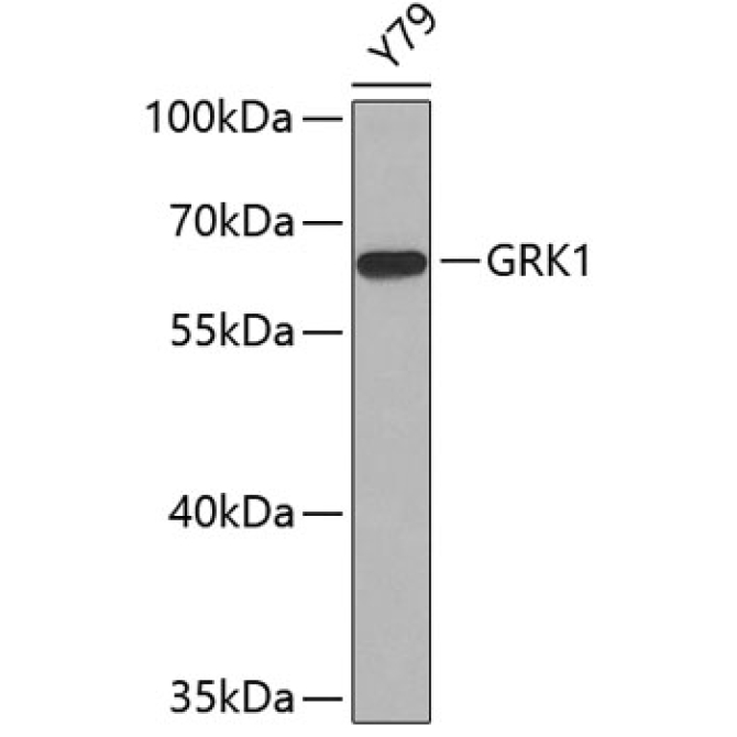 GRK1 Rabbit Polyclonal Antibody